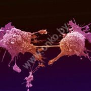 Так происходит деление клеток рака, при заболевании раком легкого